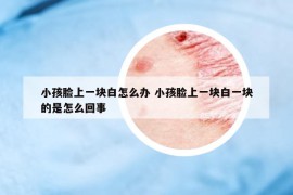 小孩脸上一块白怎么办 小孩脸上一块白一块的是怎么回事