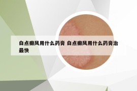 白点癫风用什么药膏 白点癫风用什么药膏治最快
