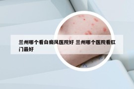 兰州哪个看白癜风医院好 兰州哪个医院看肛门最好