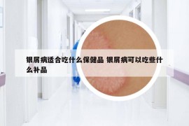 银屑病适合吃什么保健品 银屑病可以吃些什么补品