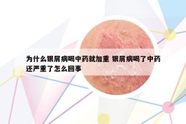 为什么银屑病喝中药就加重 银屑病喝了中药还严重了怎么回事