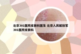 北京301医院皮肤科医生 北京人民解放军301医院皮肤科
