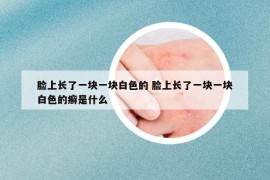 脸上长了一块一块白色的 脸上长了一块一块白色的癣是什么