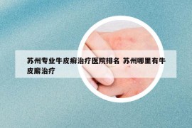 苏州专业牛皮癣治疗医院排名 苏州哪里有牛皮廨治疗