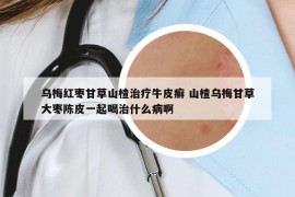 乌梅红枣甘草山楂治疗牛皮癣 山楂乌梅甘草大枣陈皮一起喝治什么病啊