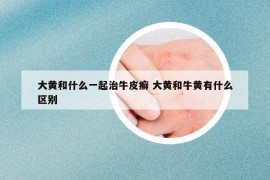 大黄和什么一起治牛皮癣 大黄和牛黄有什么区别