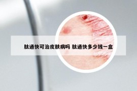 肽通快可治皮肤病吗 肽通快多少钱一盒