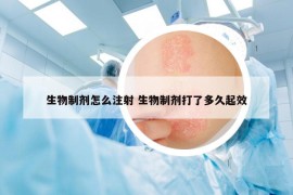 生物制剂怎么注射 生物制剂打了多久起效