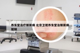 养生堂治疗银屑病 北京卫视养生堂治银屑病视频