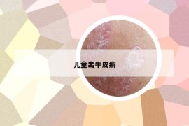 儿童出牛皮癣