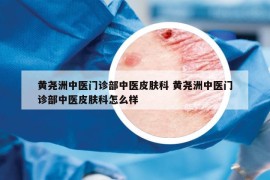 黄尧洲中医门诊部中医皮肤科 黄尧洲中医门诊部中医皮肤科怎么样