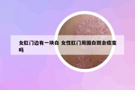 女肛门边有一块白 女性肛门周围白斑会癌变吗