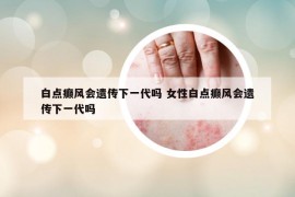 白点癫风会遗传下一代吗 女性白点癫风会遗传下一代吗