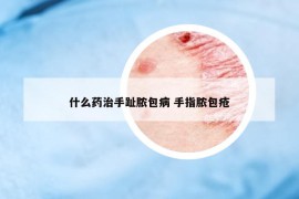 什么药治手趾脓包病 手指脓包疮