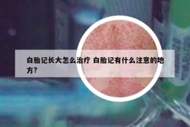 白胎记长大怎么治疗 白胎记有什么注意的地方?