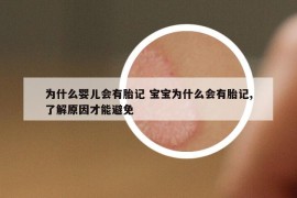 为什么婴儿会有胎记 宝宝为什么会有胎记,了解原因才能避免