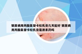 银屑病用丙酸氟替卡松乳膏几天能好 银屑病用丙酸氟替卡松乳膏是激素药吗