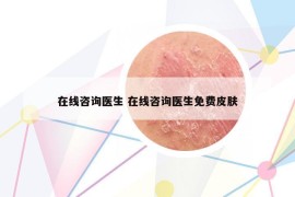 在线咨询医生 在线咨询医生免费皮肤