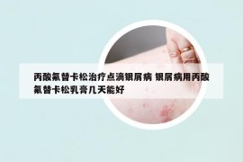 丙酸氟替卡松治疗点滴银屑病 银屑病用丙酸氟替卡松乳膏几天能好