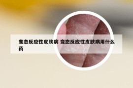 变态反应性皮肤病 变态反应性皮肤病用什么药