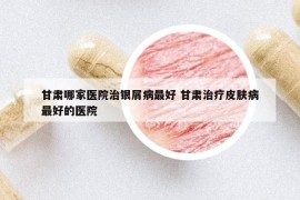 甘肃哪家医院治银屑病最好 甘肃治疗皮肤病最好的医院