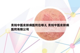 贵阳中医皮肤病医院在哪儿 贵阳中医皮肤病医院有限公司