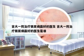 吉大一院治疗银屑病最好的医生 吉大一院治疗银屑病最好的医生是谁