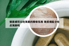 银屑病可以吃海里的那些东西 银屑病能少吃点海鲜吗