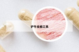 铲牛皮癣工具