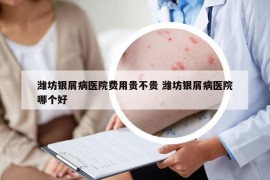 潍坊银屑病医院费用贵不贵 潍坊银屑病医院哪个好