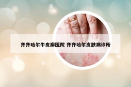 齐齐哈尔牛皮癣医院 齐齐哈尔皮肤病诊所