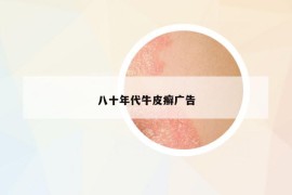 八十年代牛皮癣广告