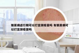 银屑病进行期可以打宫颈疫苗吗 有银屑病可以打宫颈疫苗吗
