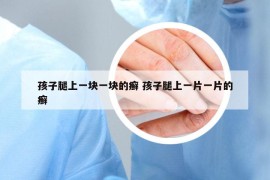 孩子腿上一块一块的癣 孩子腿上一片一片的癣