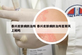 泰兴皮肤病防治所 泰兴皮肤病防治所星期天上班吗