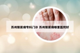 苏州银屑病专科门诊 苏州银屑病哪里医院好
