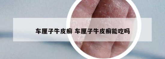 车厘子牛皮癣 车厘子牛皮癣能吃吗