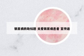 银屑病救助标题 关爱银屑病患者 宣传语