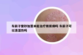 车前子蚕砂加薏米能治疗银屑病吗 车前子可以清湿热吗