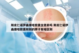 斯皮仁诺伊曲康唑胶囊含激素吗 斯皮仁诺伊曲康唑胶囊和别的牌子有啥区别
