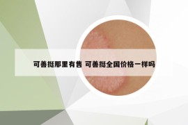 可善挺那里有售 可善挺全国价格一样吗