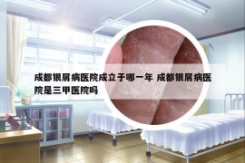 成都银屑病医院成立于哪一年 成都银屑病医院是三甲医院吗