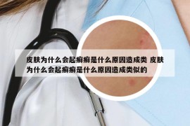 皮肤为什么会起癣癣是什么原因造成类 皮肤为什么会起癣癣是什么原因造成类似的