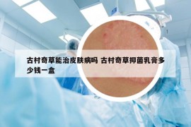 古村奇草能治皮肤病吗 古村奇草抑菌乳膏多少钱一盒