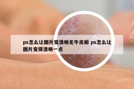 ps怎么让图片变清晰无牛皮癣 ps怎么让图片变得清晰一点