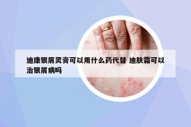 迪康银屑灵膏可以用什么药代替 迪肤霜可以治银屑病吗