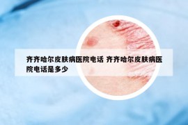 齐齐哈尔皮肤病医院电话 齐齐哈尔皮肤病医院电话是多少