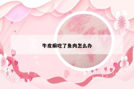 牛皮癣吃了鱼肉怎么办