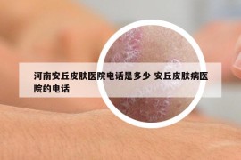 河南安丘皮肤医院电话是多少 安丘皮肤病医院的电话