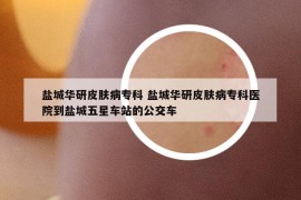 盐城华研皮肤病专科 盐城华研皮肤病专科医院到盐城五星车站的公交车